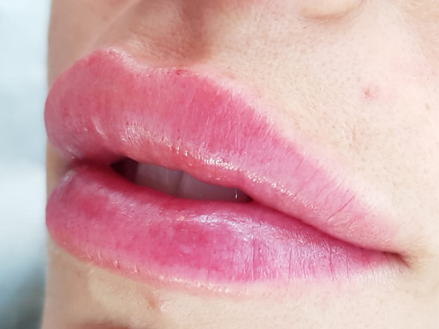 permanent-lip-blush-lip-micropigmentation